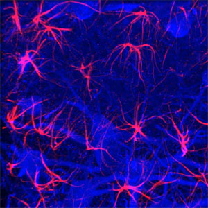 GFAP and Neun piSeeDB