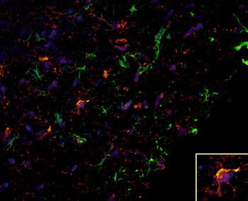 An image of a special brain scan